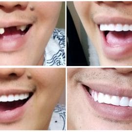 Instant Smile Comfort Fit Flex - Bright White Shade - Image 4