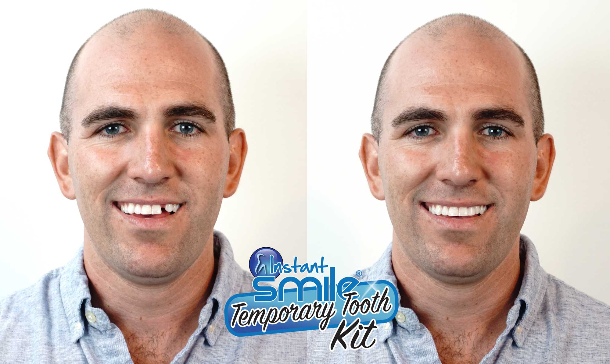 Instant Smile Triple Shade Temporary Tooth Kit - Instant Smile