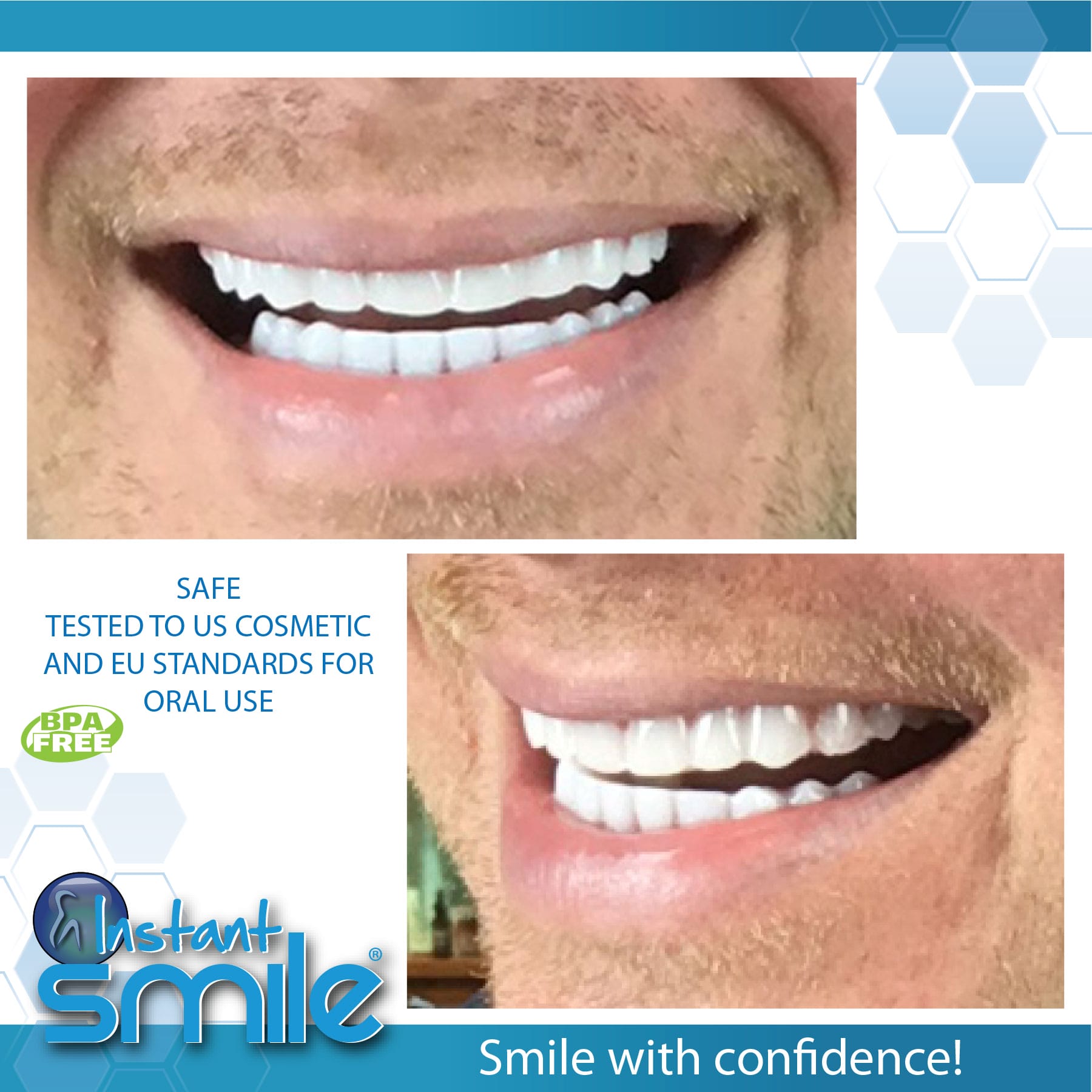 Instant Smile Flex Bright White - Upper and Lower Set - Instant Smile