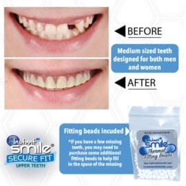 Instant Smile Secure Fit Upper Teeth - Image 4